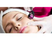 TRATAMIENTO DE REJUVENECIMIENTO FACIAL 2X1 PARA VOS Y UNA AMIGA