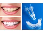 Blanqueamiento dental con placas