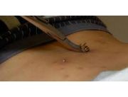 Apiterapia Abejas Que Curan