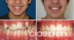 ODONTOLOGIA; ORTODONCIA CON 50% DE DESCUENTO — foto 3