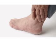 APITERAPIA y ARTRITIS