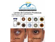 Lentes de Contacto Protesicas