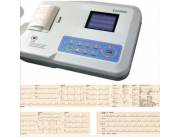 Electrocardiograma a domicilio (ECG).