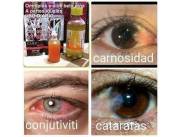 Sufres de cataratas, carnosidad, ect?
