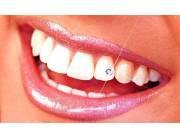 Piercing Dental