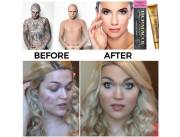 Dermacol